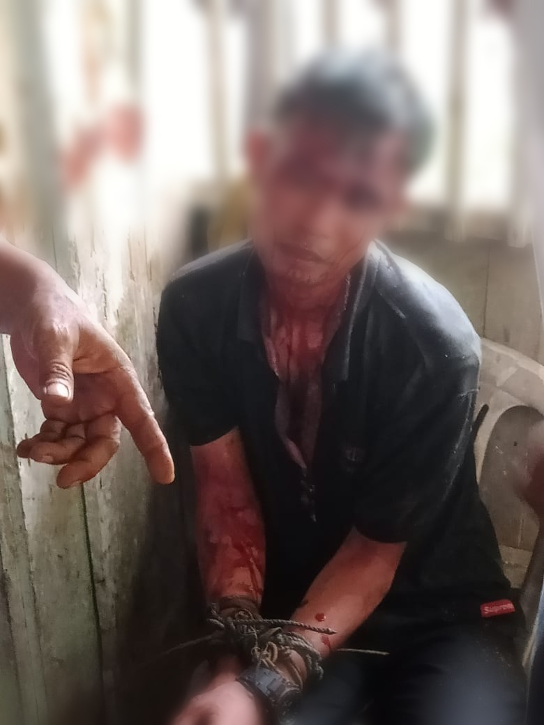 Seorang Pemuda Babak Belur Di Hajar Warga