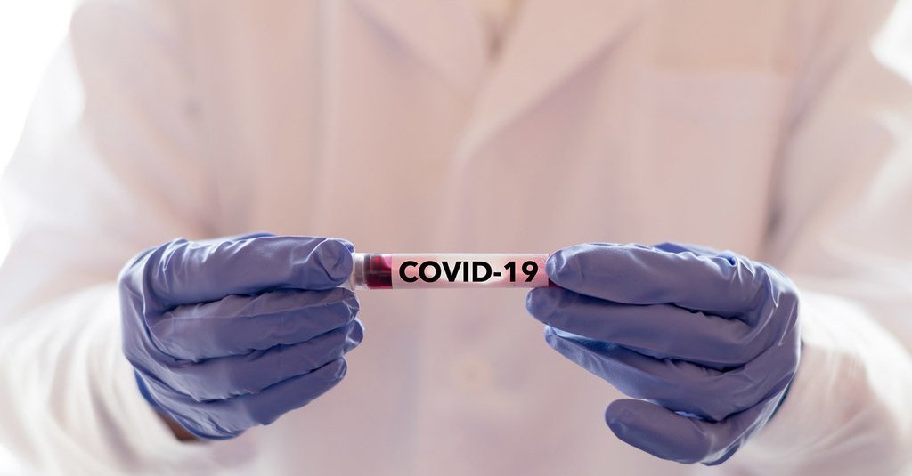 Positif Corona di Jambi Sudah 1.384 Orang, Sembuh 860, dan Meninggal 25 Orang